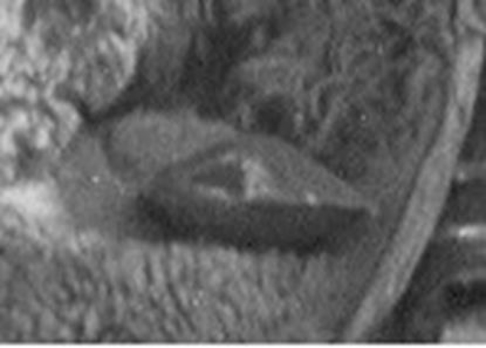 Разбор всех фотографий поисковиков группы Дятлова