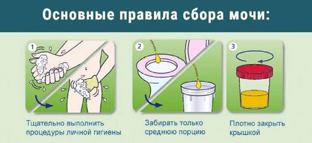 Белок в моче у ребенка: 7 причин повышения уровня белка, расшифровка результатов