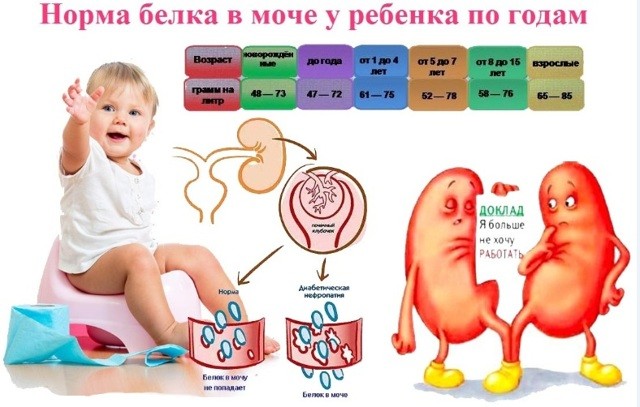 Белок в моче у ребенка: 7 причин повышения уровня белка, расшифровка результатов