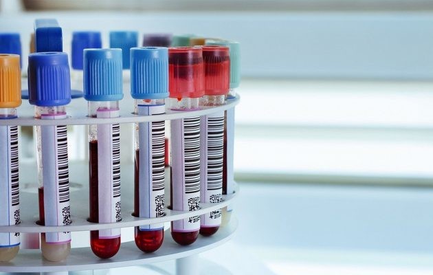 Базофилы повышены у ребёнка: 2 причины, 2 способа определения, норма базофилов в крови Базофилы повышены у ребёнка: 2 причины, 2 способа определения, норма базофилов в крови