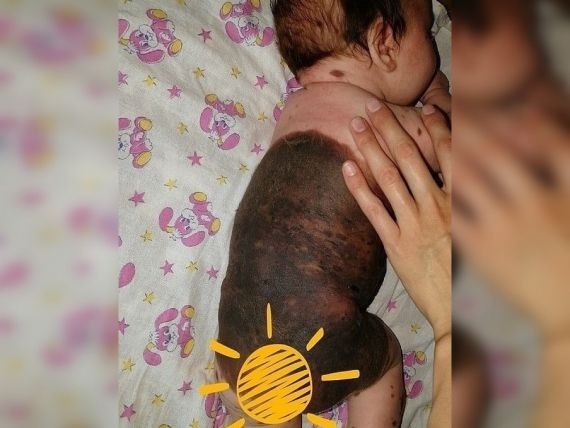 В Кургане отказались крестить ребенка с большим родимым пятном В Кургане отказались крестить ребенка с большим родимым пятном