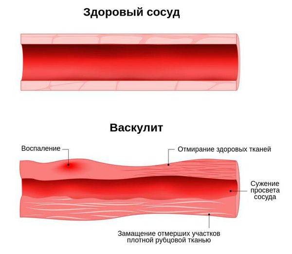 Почему лицо экс-супруги футболиста Андрея Аршавина Алисы Казьминой так изменилось Почему лицо экс-супруги футболиста Андрея Аршавина Алисы Казьминой так изменилось