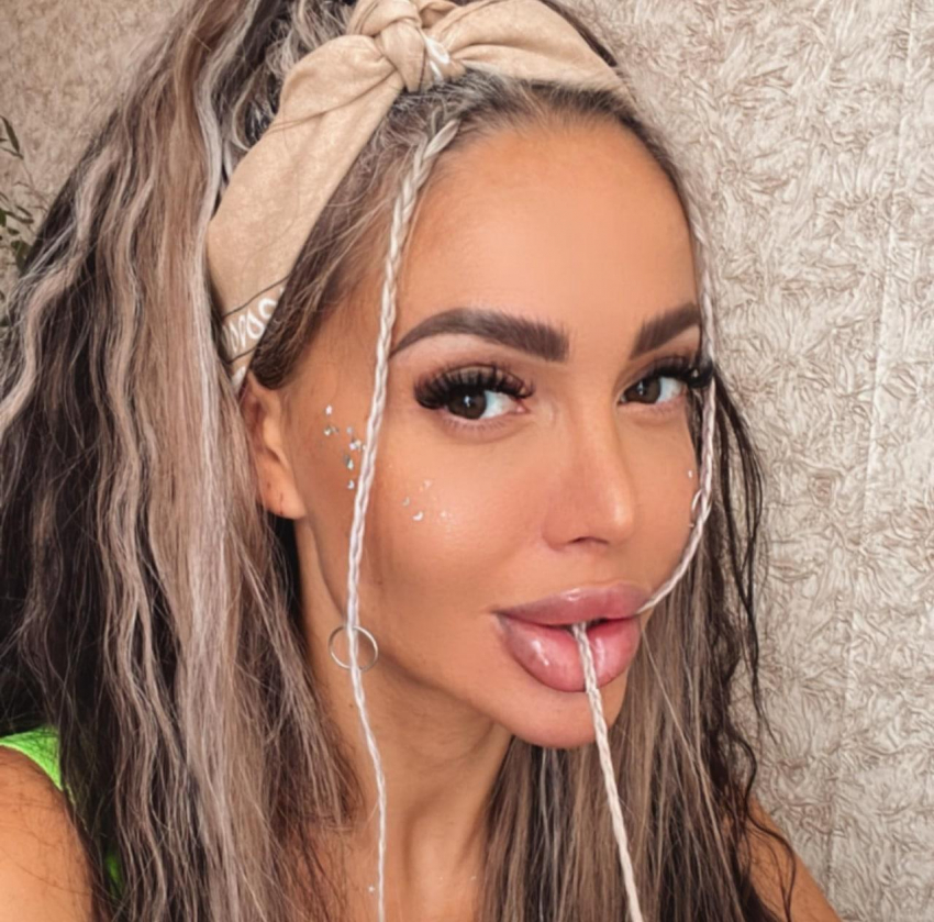 Онколог Потуданский раскрыл диагноз покрывшейся пятнами звезды «Дом-2» Белой