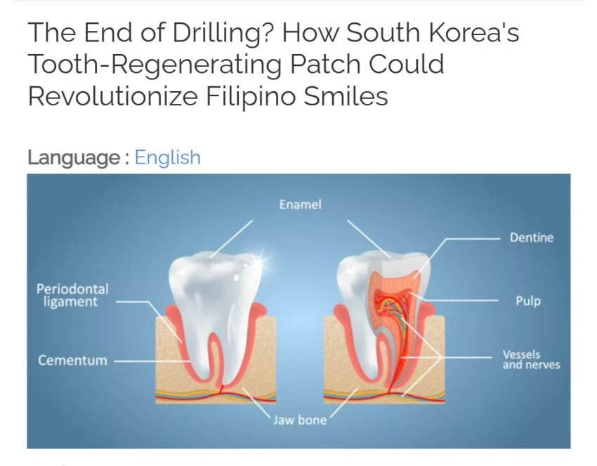 Пластырь для регенерации зубов изобрели в Корее