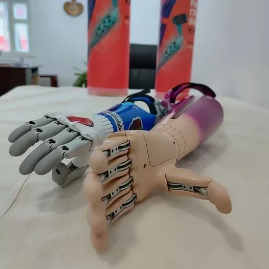 Минтруда КР: более 11,5 тысячи человек получили протезно-ортопедические услуги в 2025 году